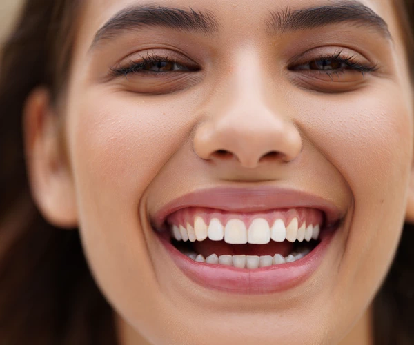 Take the first step to a dazzling smile