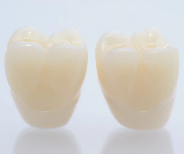 What Is a Dental Crown
